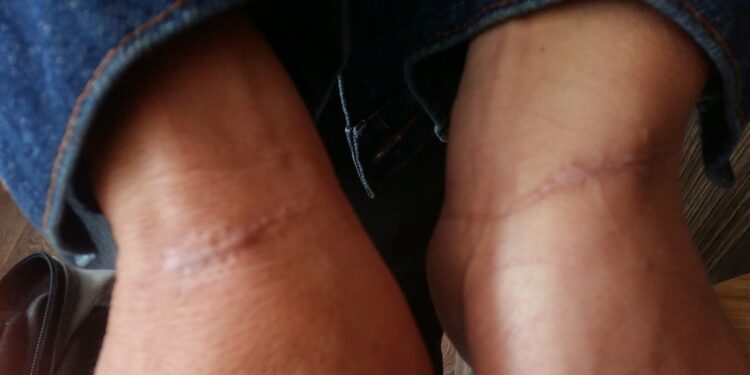 Tortura e Direitos Humanos: Um Crime que Ultrapassa Gerações